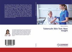 Tuberculin Skin Test: New Insight - Sawhney, Natasha