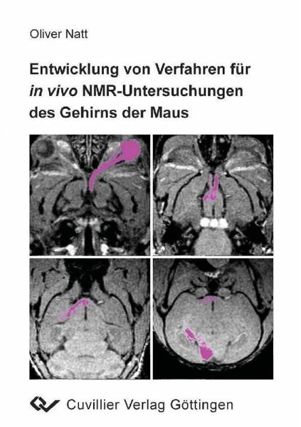 Entwicklung von Verfahren für in vivo NMR-Untersuchungen des Gehirns der Maus (eBook, PDF)