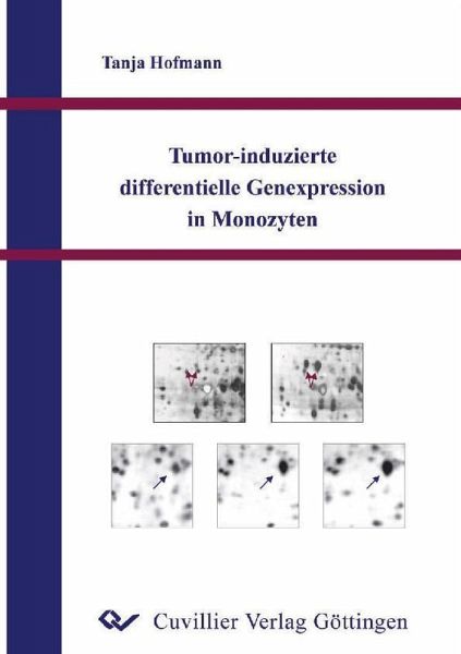 Tumor-induzierte differentielle Genexpression in Monozyten (eBook, PDF) Tumor-induzierte differentielle Genexpression in Monozyten (eBook, PDF)