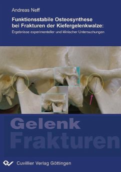 Cover Funktionsstabile Osteosynthese bei Frakturen der Kiefergelenkwalze (eBook, PDF)