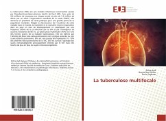 La tuberculose multifocale - Aydi, Zohra;Ben Dhaou, Besma;Seghaier, Sonia