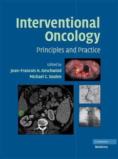 Cover Interventional Oncology (eBook, ePUB)