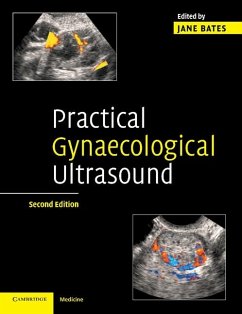 Practical Gynaecological Ultrasound (eBook, ePUB)