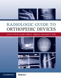 Cover Radiologic Guide to Orthopedic Devices (eBook, ePUB)