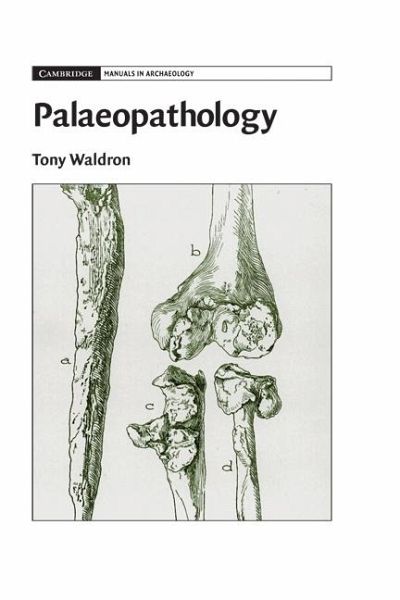Palaeopathology (eBook, ePUB)