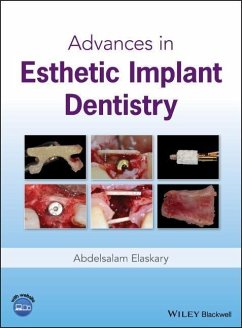 Advances in Esthetic Implant Dentistry - Elaskary, Abdelsalam
