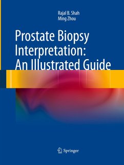 Prostate Biopsy Interpretation: An Illustrated Guide - Shah, Rajal B.;Zhou, Ming