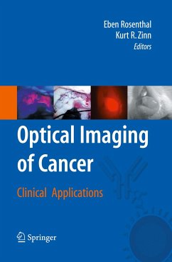 Optical Imaging of Cancer