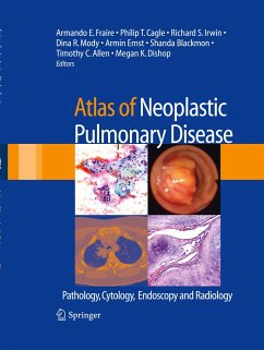 Atlas of Neoplastic Pulmonary Disease