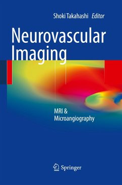 Neurovascular Imaging