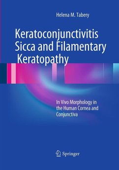 Cover Keratoconjunctivitis Sicca and Filamentary Keratopathy