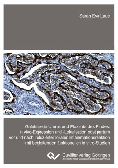 Galektine in Uterus und Plazenta des Rindes (eBook, PDF)