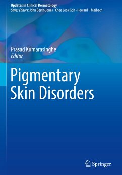 Pigmentary Skin Disorders