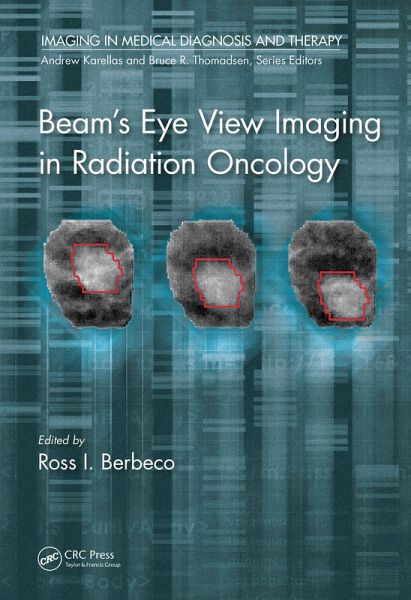 Beam's Eye View Imaging in Radiation Oncology (eBook, PDF)