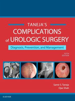 Cover Complications of Urologic Surgery E-Book (eBook, ePUB)