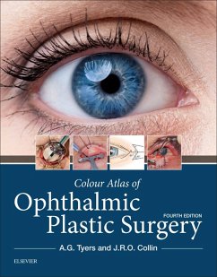 Colour Atlas of Ophthalmic Plastic Surgery E-Book (eBook, ePUB) - Tyers, Anthony G.; Collin, J. R. O.