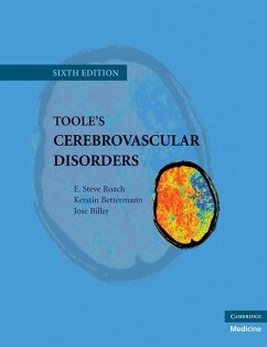 Cover Toole's Cerebrovascular Disorders (eBook, ePUB)