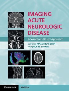Cover Imaging Acute Neurologic Disease (eBook, ePUB)