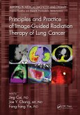 Principles and Practice of Image-Guided Radiation Therapy of Lung Cancer (eBook, ePUB)