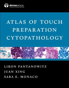 Atlas of Touch Preparation Cytopathology (eBook, ePUB) - Monaco, Sara E.; Pantanowitz, Liron; Xing, Juan