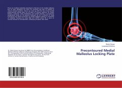 Precontoured Medial Malleolus Locking Plate