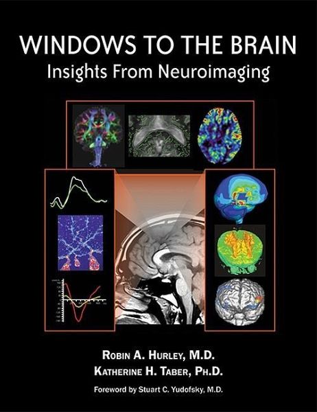 Windows to the Brain (eBook, ePUB)
