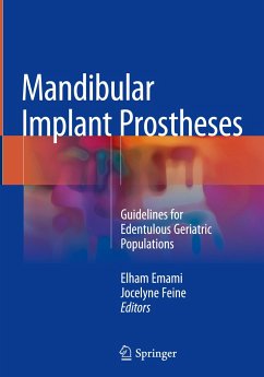 Mandibular Implant Prostheses