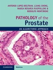 Pathology of the Prostate - Lopez-Beltran, Antonio; Cheng, Liang; Montironi, Rodolfo; Raspollini, Maria Rosaria