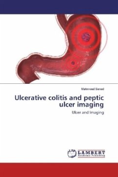 Ulcerative colitis and peptic ulcer imaging