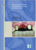 Reconstrucción de dientes endodonciados (eBook, ePUB)