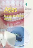 Atlas terapéutico de blanqueamiento dental (eBook, ePUB)