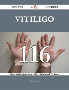 Vitiligo 116 Success Secrets - 116 Most Asked Questions On Vitiligo - What You Need To Know (eBook, ePUB)