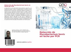 Detección de Mycobacterium bovis en leche por PCR - Leiva, Cristian Julio