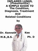Inflamed Lungs, (Pneumonitis) A Simple Guide To The Condition, Diagnosis, Treatment And Related Conditions (eBook, ePUB) Inflamed Lungs, (Pneumonitis) A Simple Guide To The Condition, Diagnosis, Treatment And Related Conditions (eBook, ePUB)