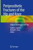 Periprosthetic Fractures of the Hip and Knee