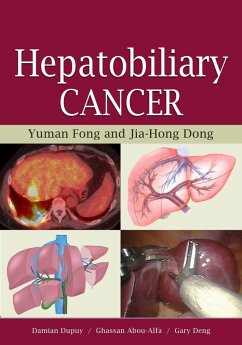 Hepatobiliary Cancer (eBook, ePUB) - Fong, Yuman