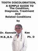 Tooth Discoloration, A Simple Guide To The Condition, Diagnosis, Treatment And Related Conditions (eBook, ePUB)