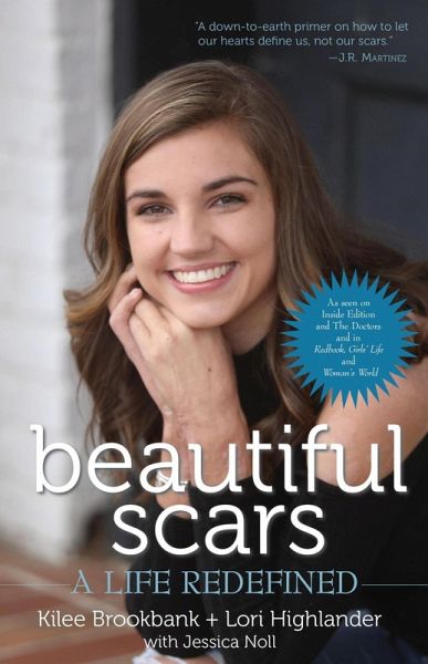 Beautiful Scars (eBook, ePUB)