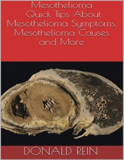 Mesothelioma: Quick Tips About Mesothelioma Symptoms, Mesothelioma Causes and More (eBook, ePUB) - Rein, Donald