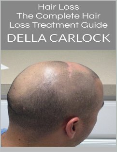 Hair Loss: The Complete Hair Loss Treatment Guide (eBook, ePUB) - Carlock, Della