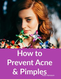 How to Prevent Acne & Pimples (eBook, ePUB) - Hansson, Kate