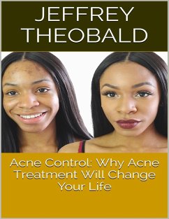 Acne Control: Why Acne Treatment Will Change Your Life (eBook, ePUB) - Theobald, Jeffrey