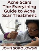 Acne Scars: The Everything Guide to Acne Scar Treatment (eBook, ePUB)