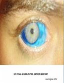 Eye Dying - Scleral Tattoo - Extreme Body Art (eBook, ePUB)