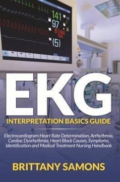 EKG Interpretation Basics Guide (eBook, ePUB)