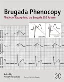 Brugada Phenocopy