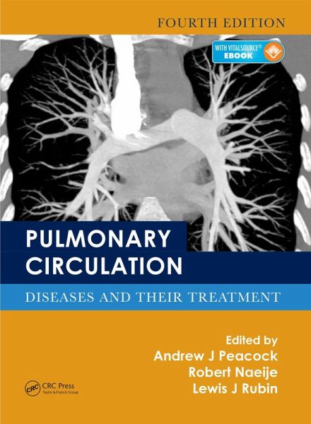 Pulmonary Circulation (eBook, ePUB)