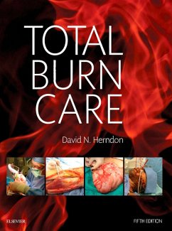 Cover Total Burn Care E-Book (eBook, ePUB)