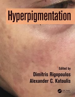 Cover Hyperpigmentation (eBook, PDF)