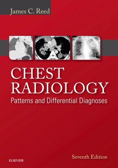 Chest Radiology: Patterns and Differential Diagnoses E-Book (eBook, ePUB) - Reed, James C.